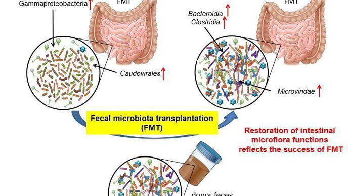 Scientists Reveal Mechanism Behind Fecal Microbiota Transplantation