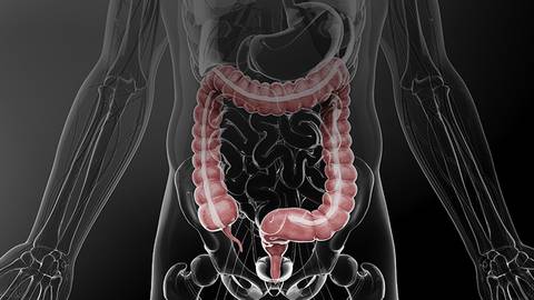 Keeping CALM in Crohn’s Disease: An Exploration of Biomarker Cutoffs & Endoscopic Outcomes