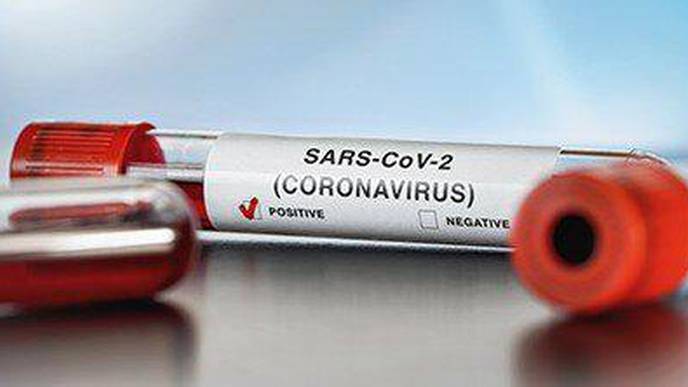 SARS-CoV-2 Protease Cuts Human Proteins Responsible for Immune Response