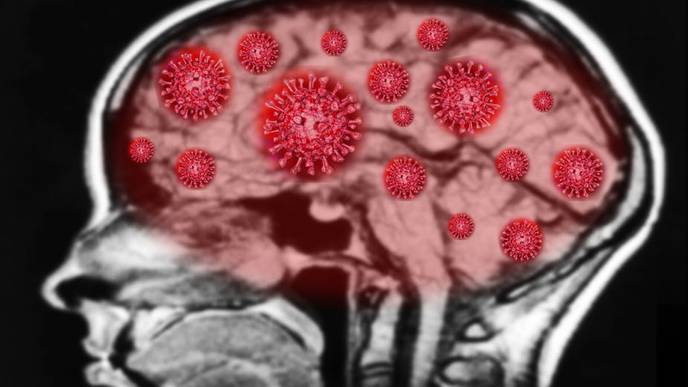 How COVID-19 Could Increase Risk of Cognitive Decline
