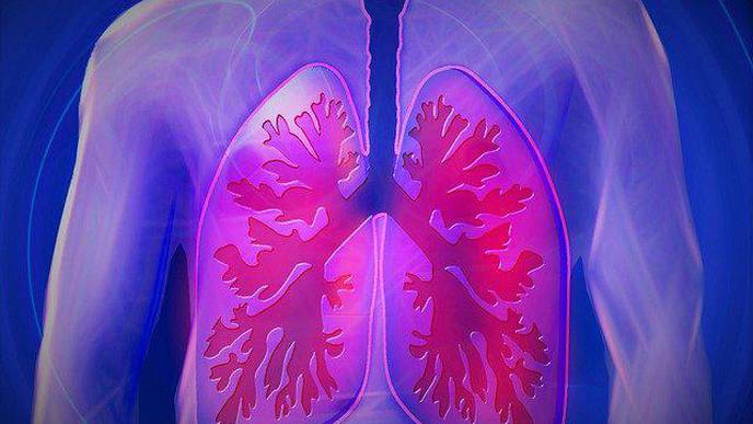 Study: Atezolizumab Extends Disease-Free Survival by More than One-Third in Subset of Patients with Lung Cancer
