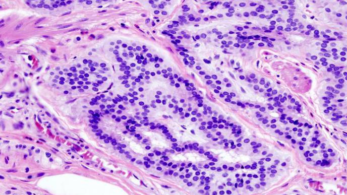 How Novel Pathogens May Cause the Development of Colorectal Cancer