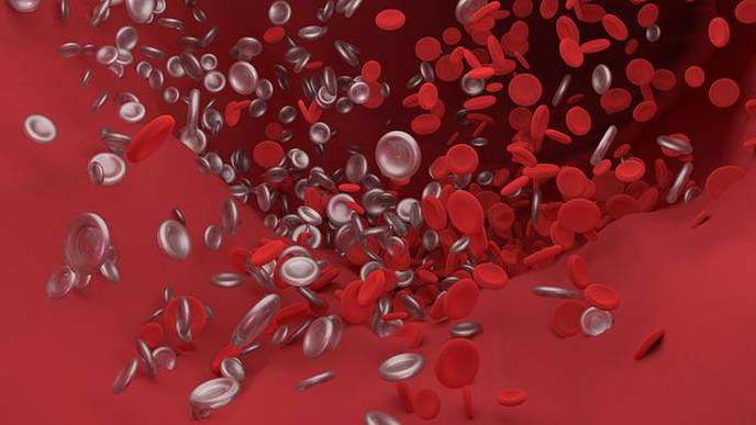 After Stroke, More Than One Try to Remove Blood Clots May Be Tied to Worse Outcome