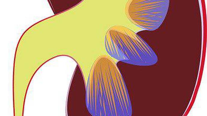 Ziltivekimab Reduced Inflammatory Biomarkers Associated with Atherosclerosis in People With Chronic Kidney Disease in Phase 2 Trial