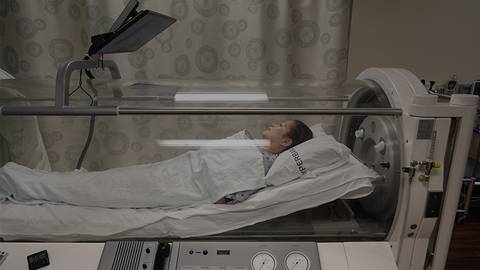 Hyperbaric Oxygen Therapy: Evaluating a Novel Approach for UC