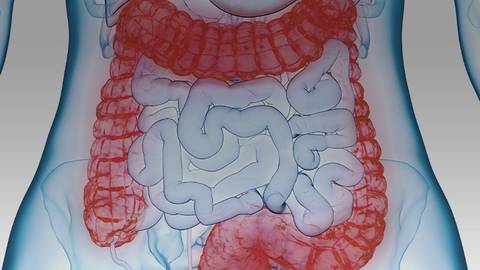 Post-Operative Management of Crohn’s Disease & Initiation of a Biologic (Video 3)