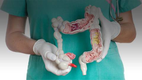 Key Surgical Indications for IBD Patients